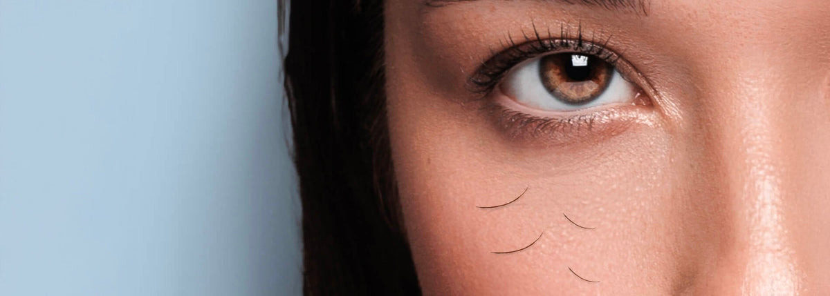 Eyelash Shedding in Autumn: Causes, Remedies, and Prevention – My ...
