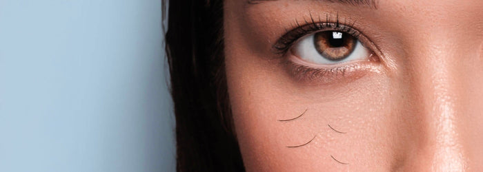 Eyelash Shedding in Autumn: Causes, Remedies, and Prevention – My ...